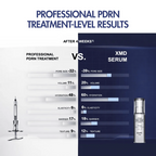 Comparison chart of professional PDRN treatment and XMD serum with text and product images.