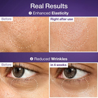 Before and after effects of a skincare product on skin texture and wrinkles.