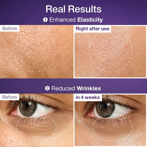 Before and after effects of a skincare product on skin texture and wrinkles.